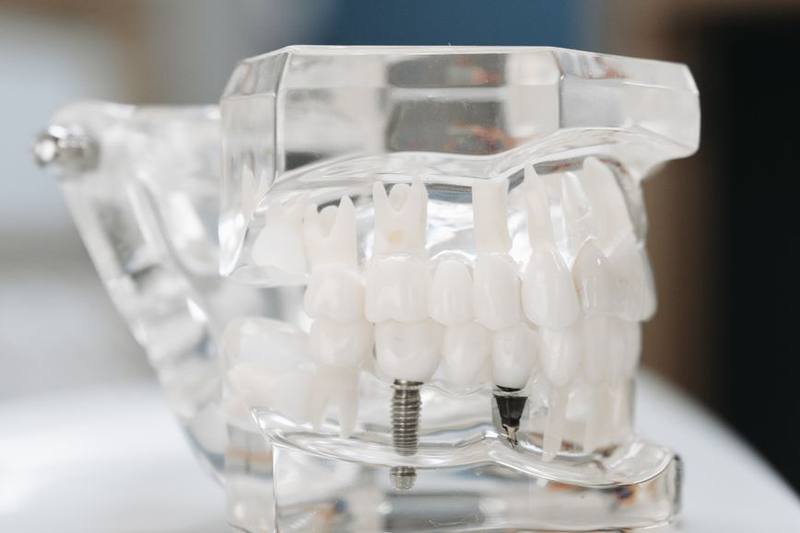 Acacia Dental & Implant Clinic